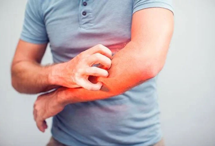 Skin Rash: Symptoms, Causes and Emergency Room Treatment